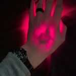 Blown Vein From Attempted IV Placement Yesterday. Shown via My Triple Deep Red TS10.