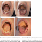 Nichia emitter getting some love in Journal of Hospital Medicine.