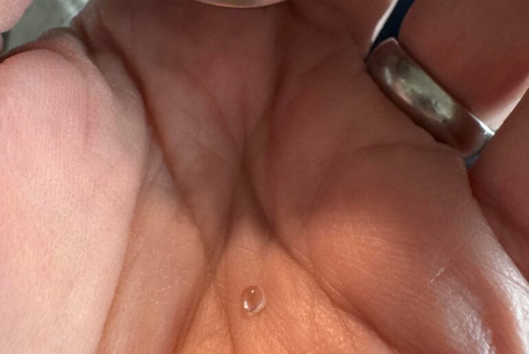 [NMD] Guess what I just did…