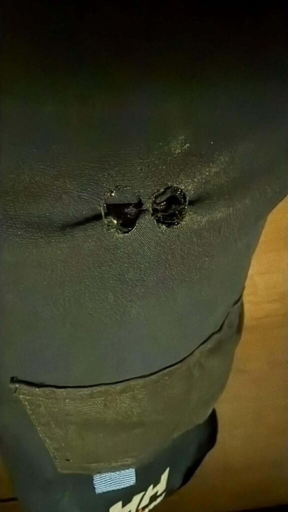 Burned hole in my pants