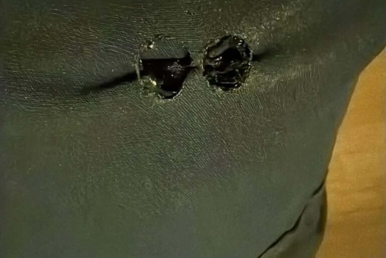 Burned hole in my pants