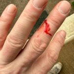 I’m sorry. I judged you all too harshly. Details below (**Injury!!**) photo.