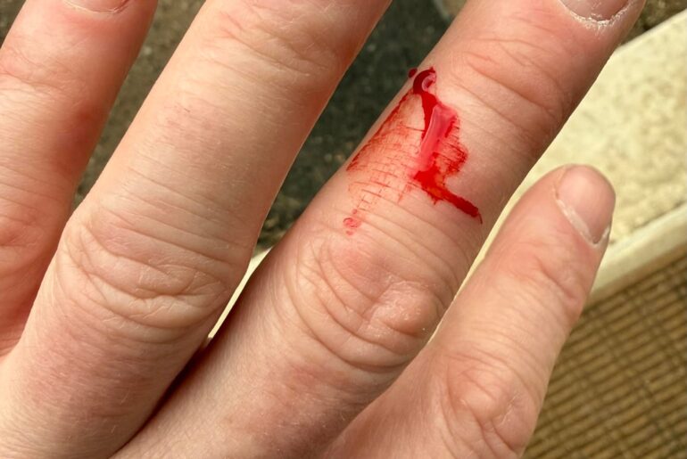 I’m sorry. I judged you all too harshly. Details below (**Injury!!**) photo.