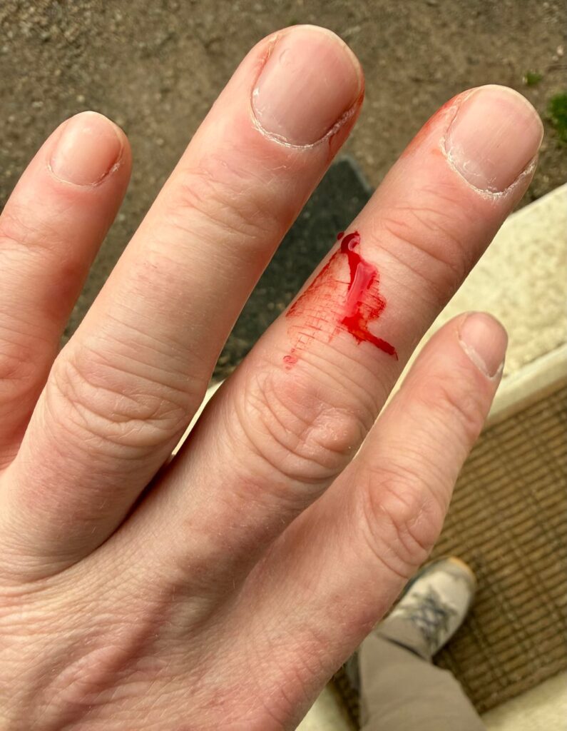 I’m sorry. I judged you all too harshly. Details below (**Injury!!**) photo.
