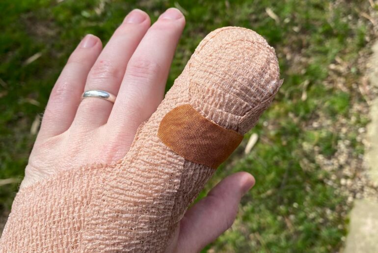 Watch those digits boys