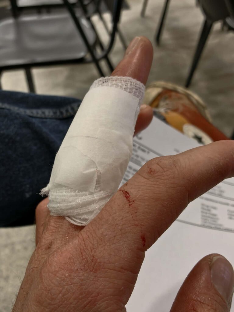 I cut myself with a butterknife so badly that I needed stitches. It turns out that butter knives are still sharp ¯_(ツ)_/¯